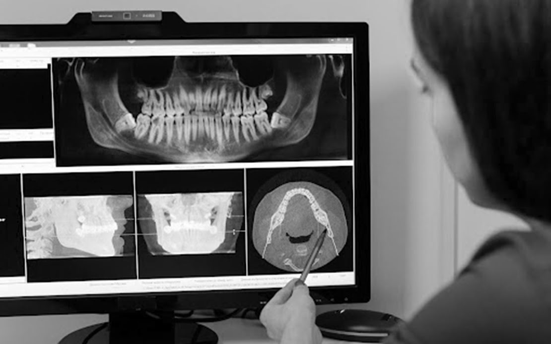 Dentist studying x-rays of teeth